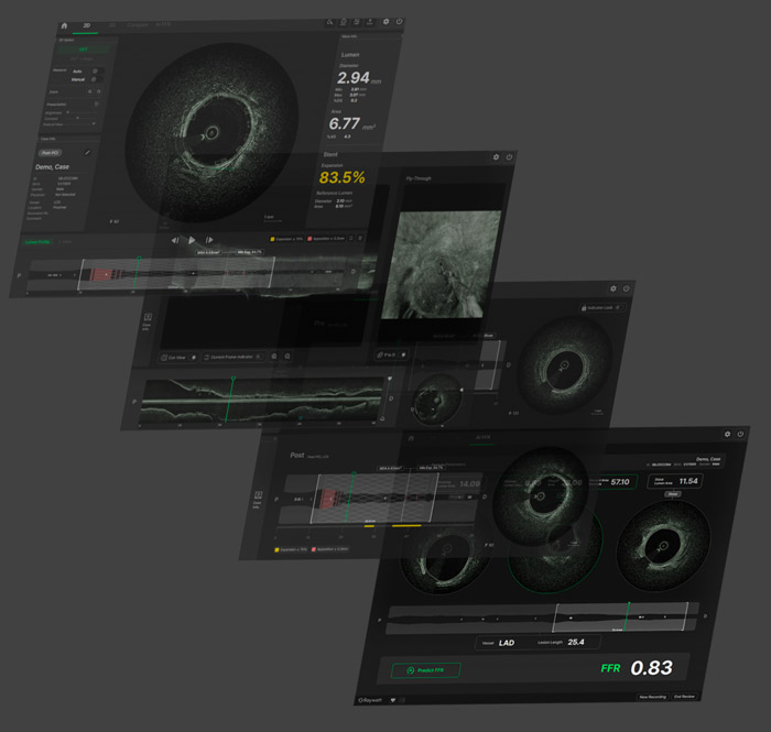 OCT Imaging Software